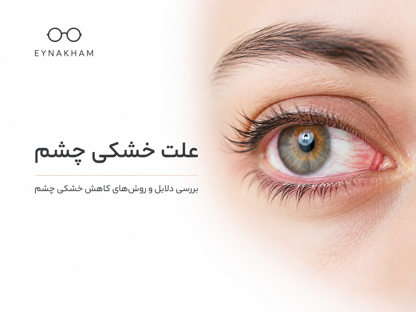 علت خشکی چشم چیست؟ بررسی علائم، دلایل و روش‌های کاهش خشکی چشم 👁️💧