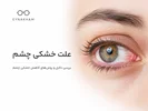 علت خشکی چشم چیست؟ بررسی علائم، دلایل و روش‌های کاهش خشکی چشم 👁️💧